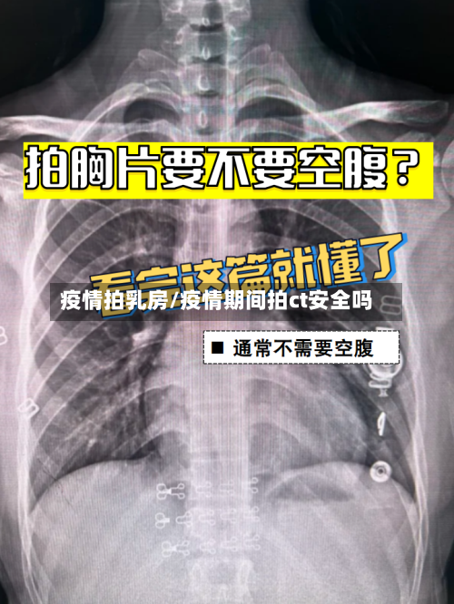 疫情拍乳房/疫情期间拍ct安全吗-第2张图片
