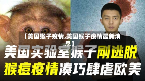 【美国猴子疫情,美国猴子疫情最新消息】-第2张图片
