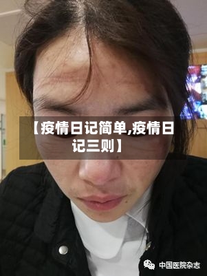 【疫情日记简单,疫情日记三则】-第3张图片