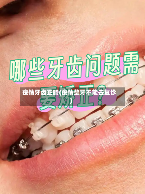 疫情牙齿正畸(疫情整牙不能去复诊)-第3张图片