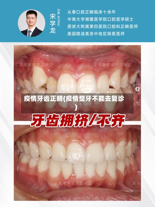 疫情牙齿正畸(疫情整牙不能去复诊)-第1张图片