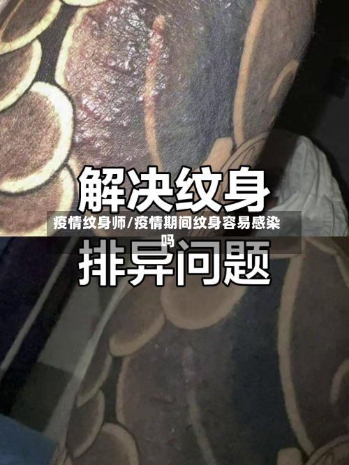疫情纹身师/疫情期间纹身容易感染吗-第3张图片