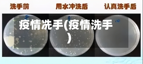 疫情冼手(疫情洗手)-第2张图片