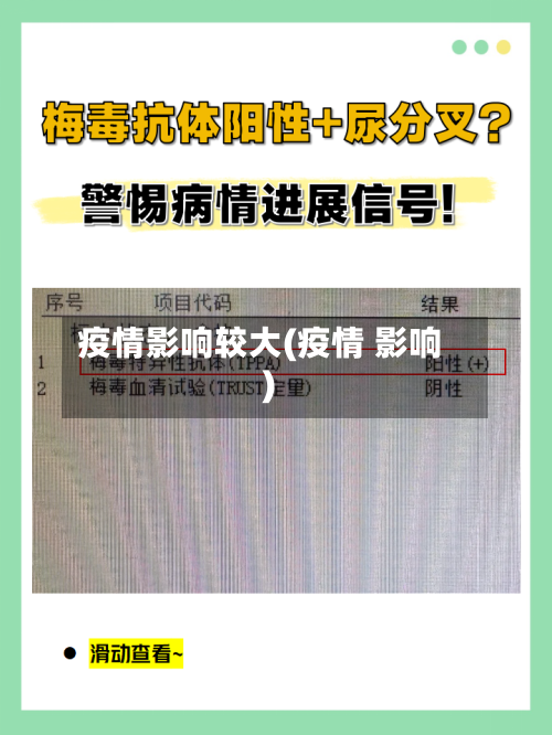 疫情影响较大(疫情 影响)-第2张图片